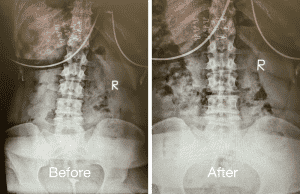 Chiropractic Adjustment Austin | Espinoza Chiropractic | Chiropractor In Austin Tx | Chiropractor Austin Tx