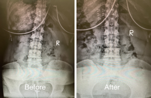 Chiropractic Adjustment Austin | Espinoza Chiropractic | Chiropractor In Austin Tx | Chiropractor Austin Tx
